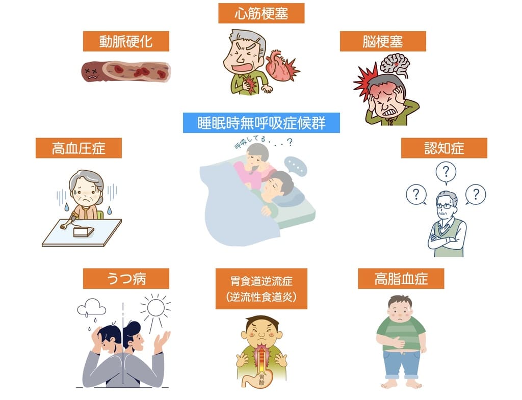 睡眠時無呼吸症候群の合併症の解説画像