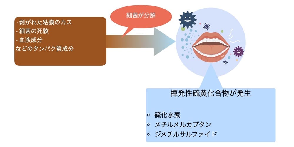 口臭発生の仕組みの説明画像
