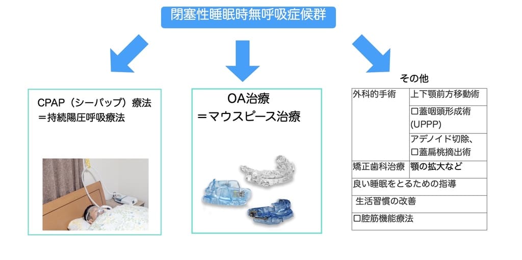 睡眠時無呼吸症候群の治し方の方法の解説画像