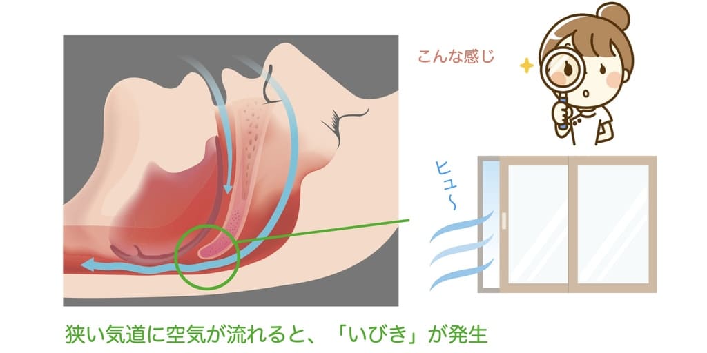 いびきの仕組みの解説画像