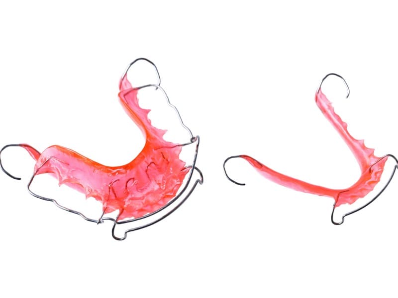 子供の歯の矯正（床矯正装置）の画像