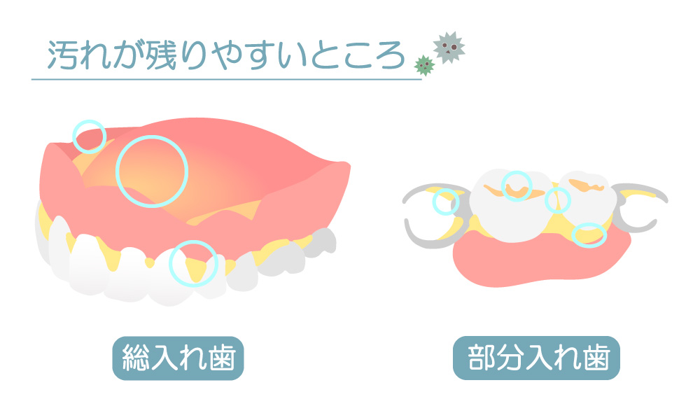 入れ歯の汚れ