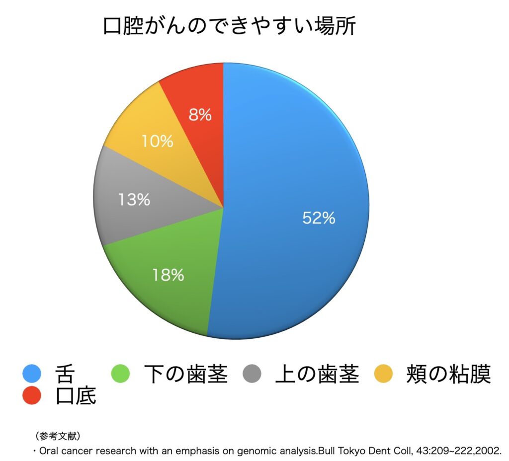 口腔がんのできやすい場所