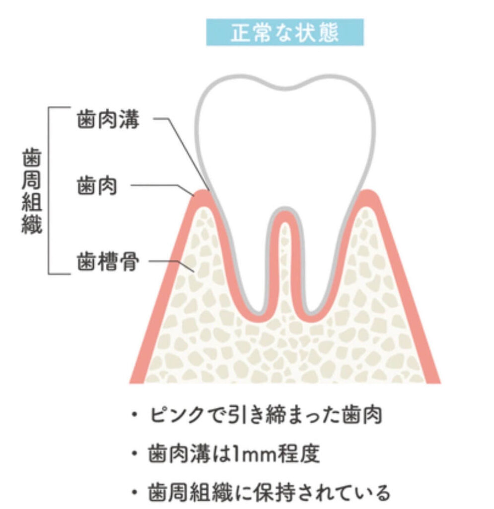 正常な歯周組織