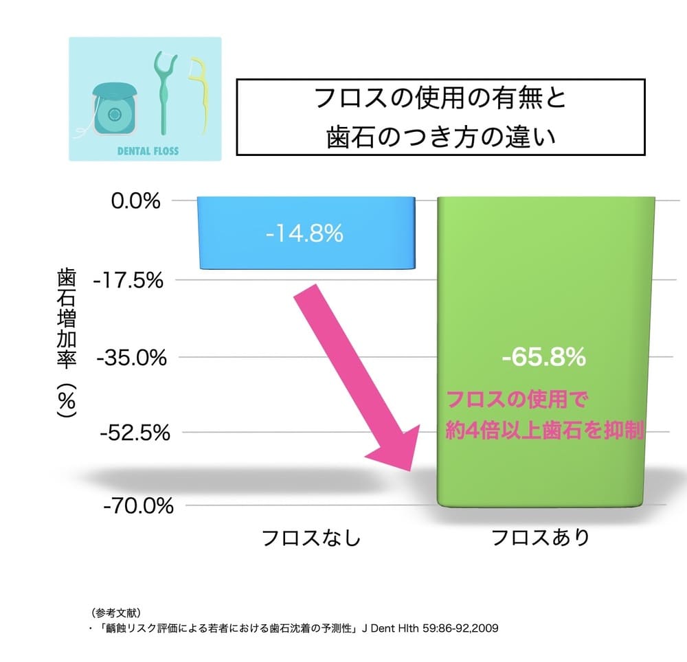 フロスの使用による歯石の抑制効果