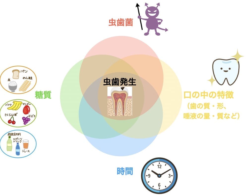 虫歯ができる原因