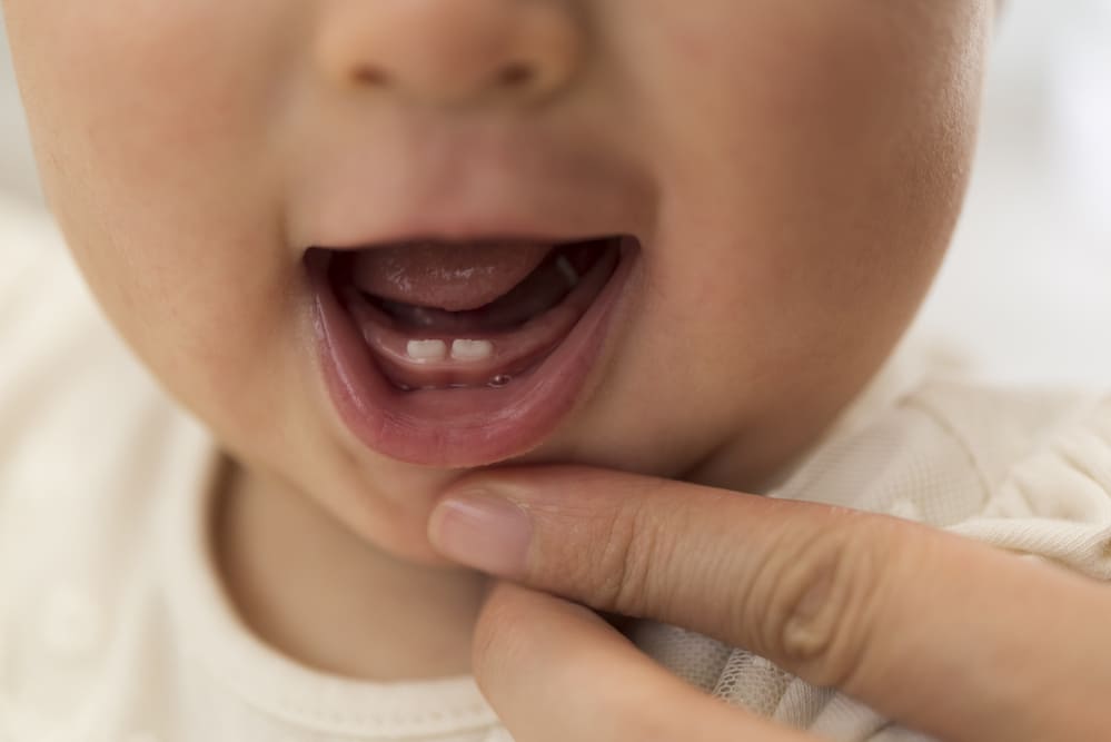 赤ちゃんの歯の生え始めの画像