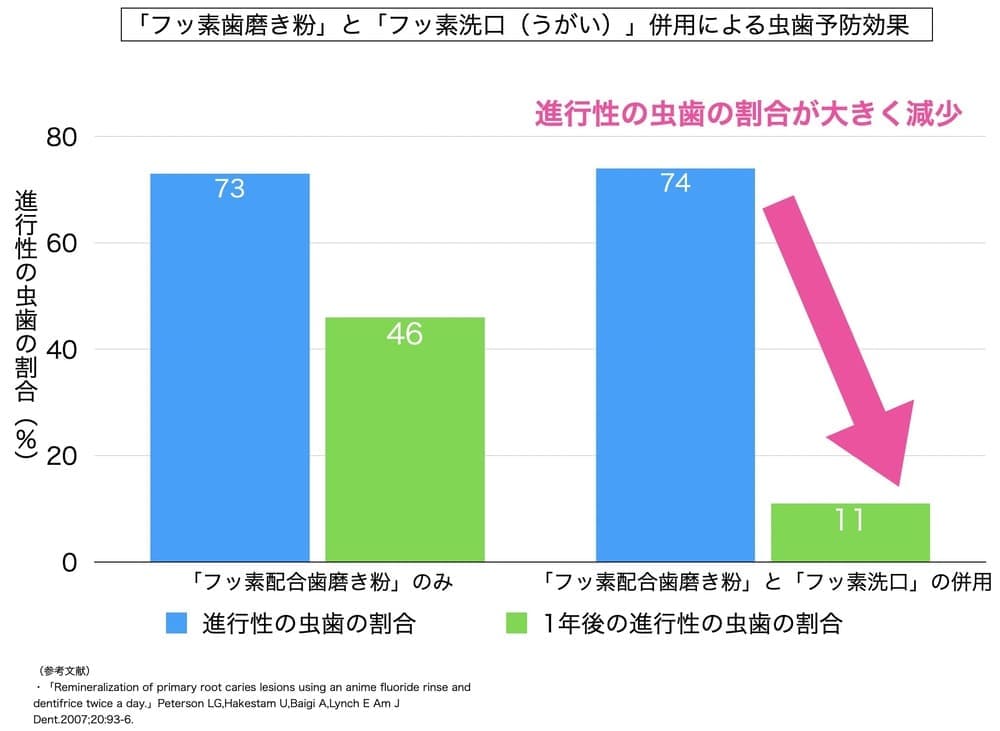 フッ素配合歯磨き粉とフッ素洗口（うがい）の虫歯予防効果を示すグラフ画像