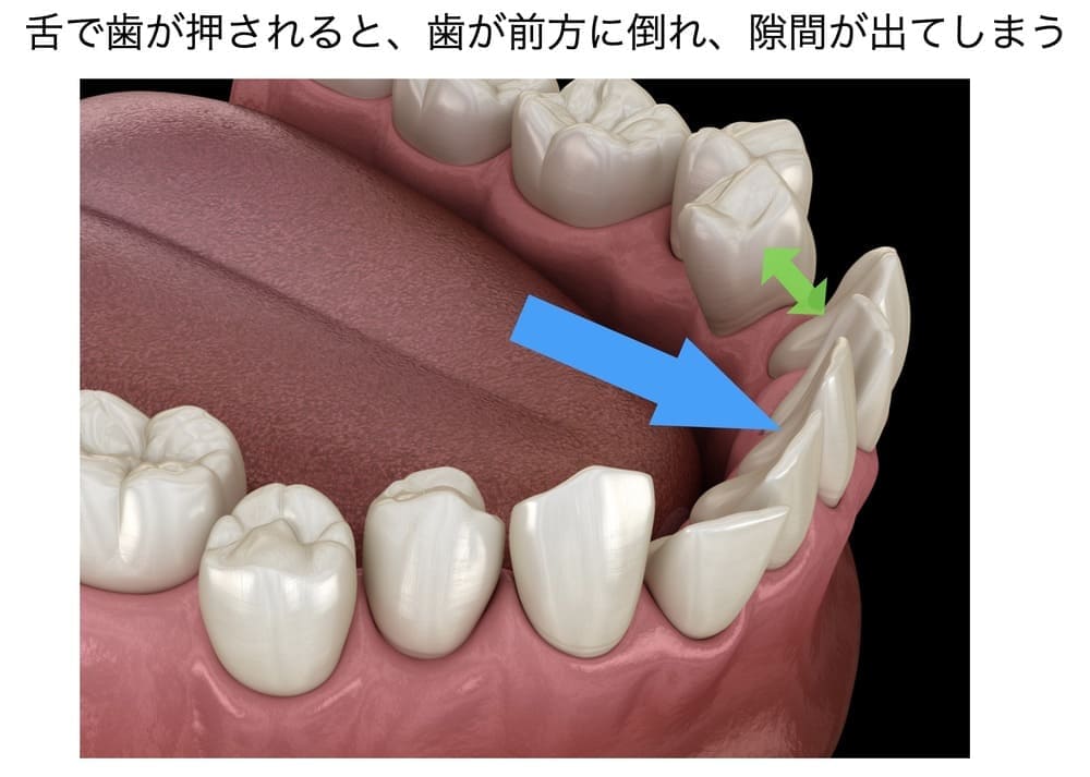 舌で歯を押す画像