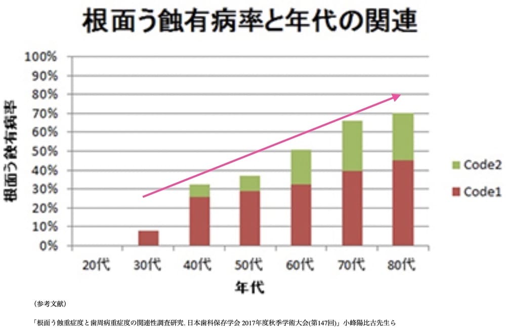 歯の付け根の虫歯