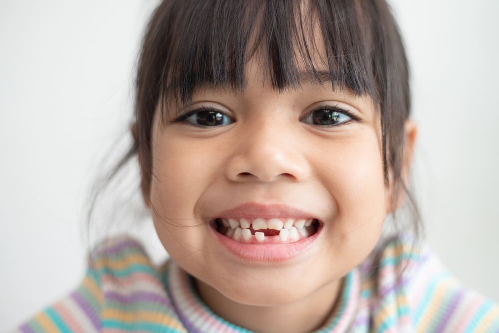 乳歯が生え変わった子供の画像 