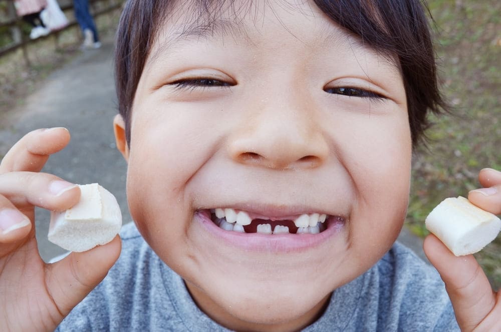 歯の生え変わり時期の子供の画像