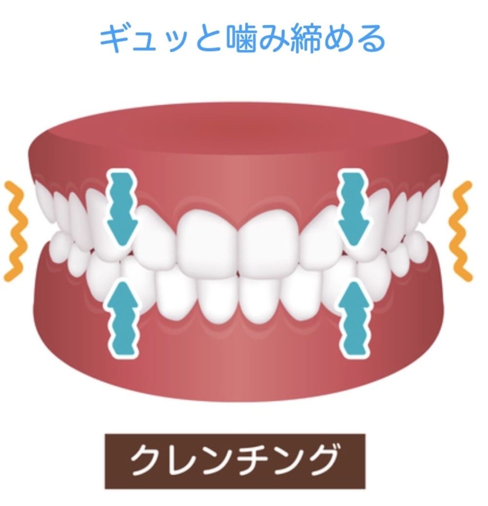 歯を噛み締める歯ぎしりのイラスト画像