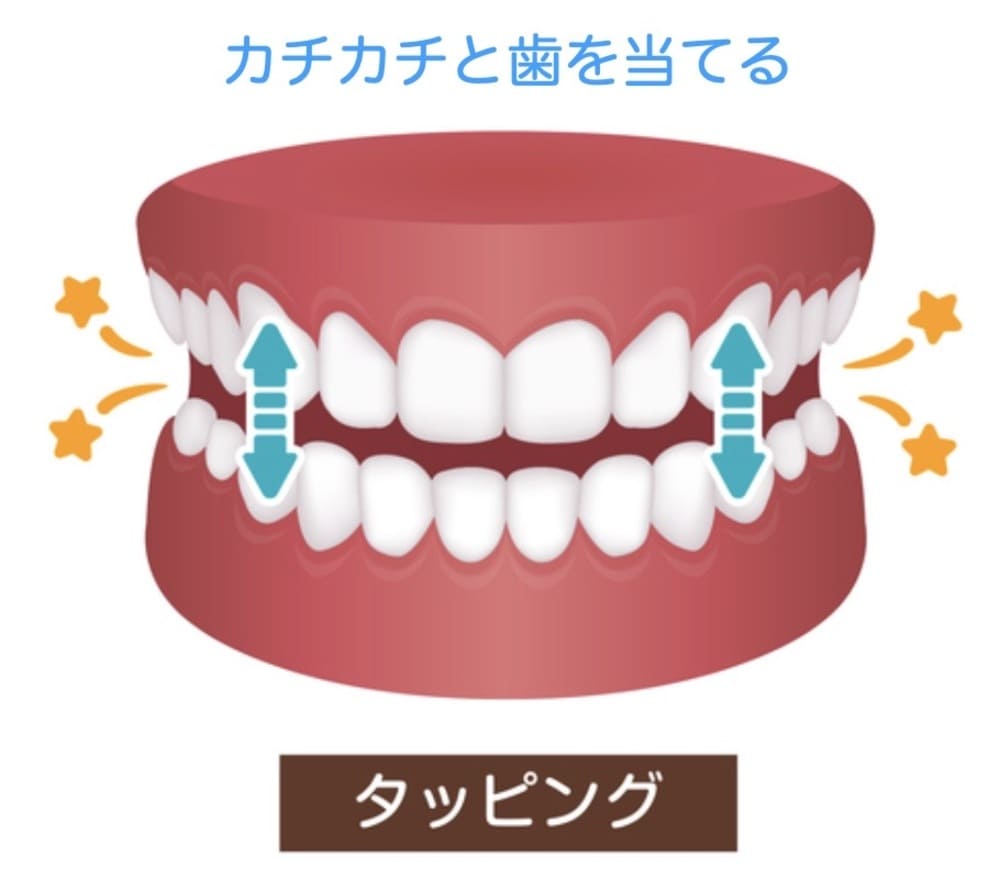 歯を噛み合わせる歯ぎしりのイラスト画像