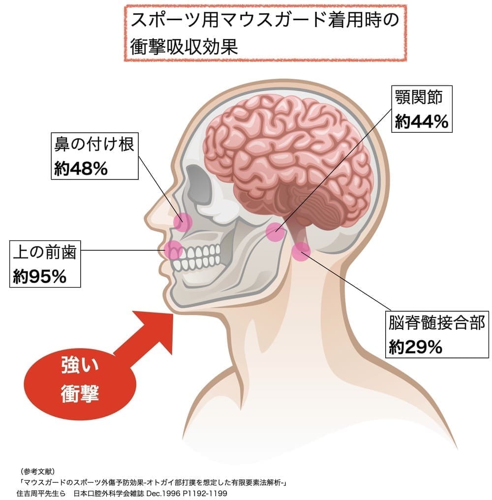 スポーツ用マウスガード着用による衝撃吸収効果