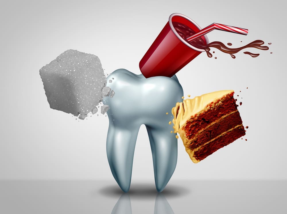 砂糖で溶かされる歯の画像