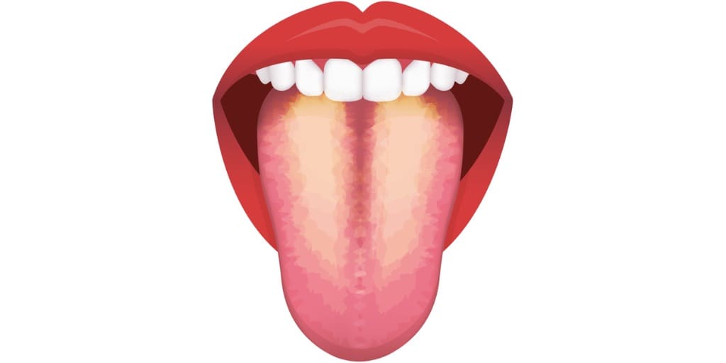 口臭の原因となる舌苔の画像