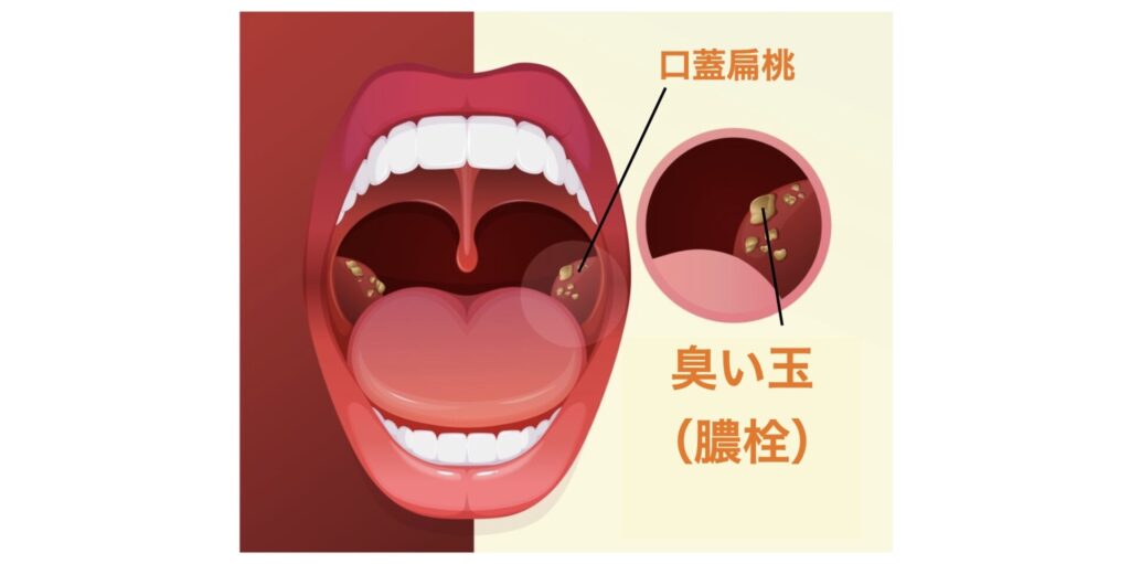 ゲロの臭いを取る方法 | ゲロの匂いを消す方法 – ゲロの臭い取りは簡単!!誰でもすぐとれる方法! – MOLQBO