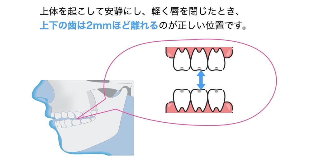 顎の正しい位置を示す画像