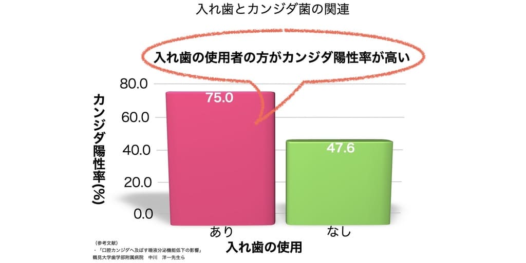 入れ歯と口腔カンジダ症の関連を示す画像