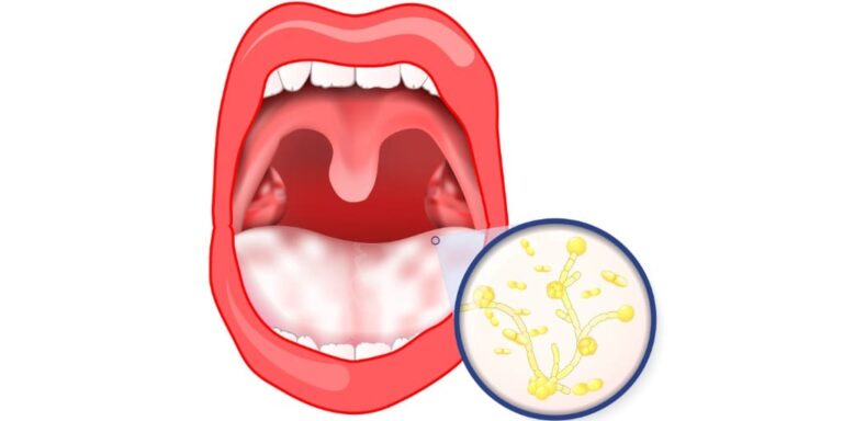 医師に連絡する時期