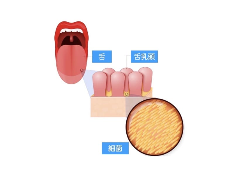 舌苔の解説画像