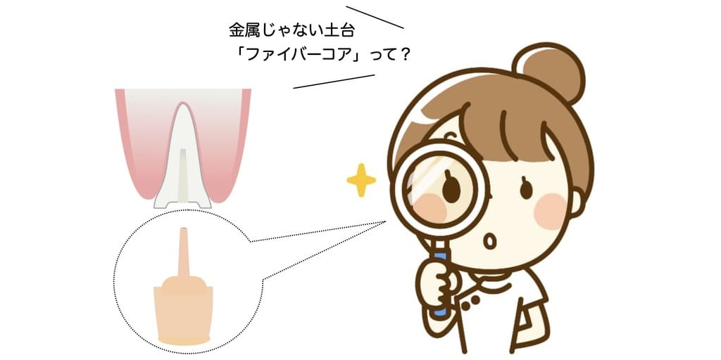 金属ではない差し歯の土台の画像