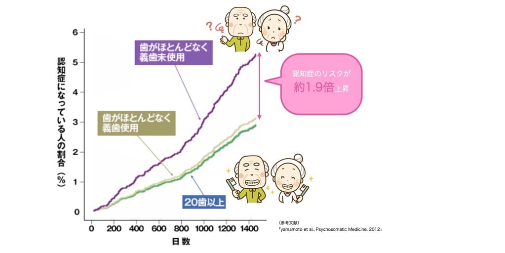 歯の本数と認知症のなりやすさの関係の画像