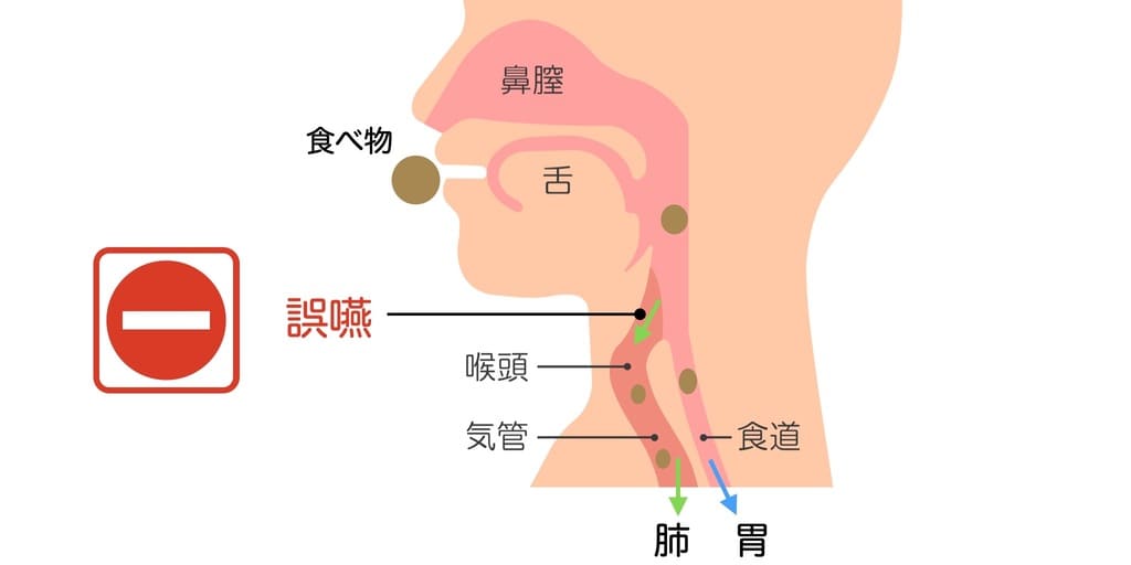 誤嚥の仕組みを示す画像