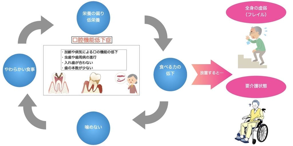 口腔機能低下症と全身の虚弱の関係の画像