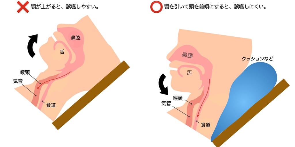 誤嚥やすい姿勢の画像