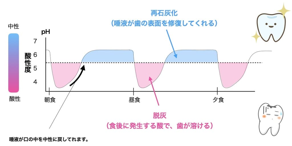 歯の脱灰と再石灰化の画像