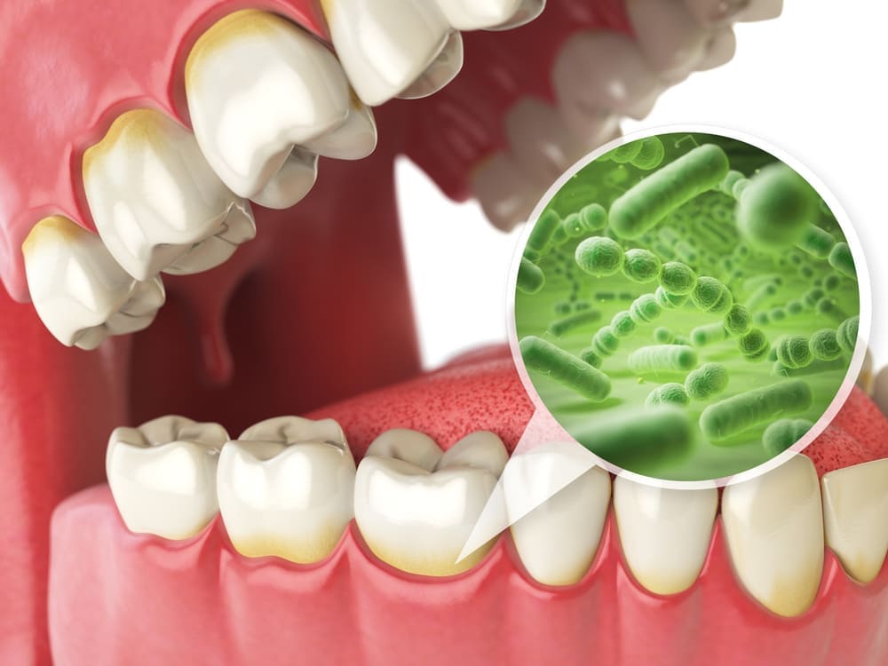 口の中の細菌の画像