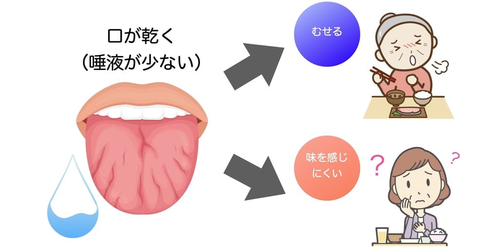 口の乾燥と誤嚥、味覚障害の関係を示す画像