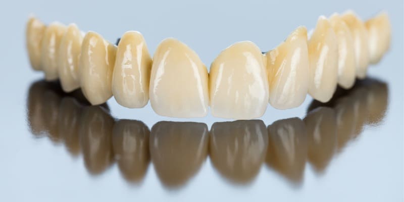 メタルボンド（歯科セラミック）の画像