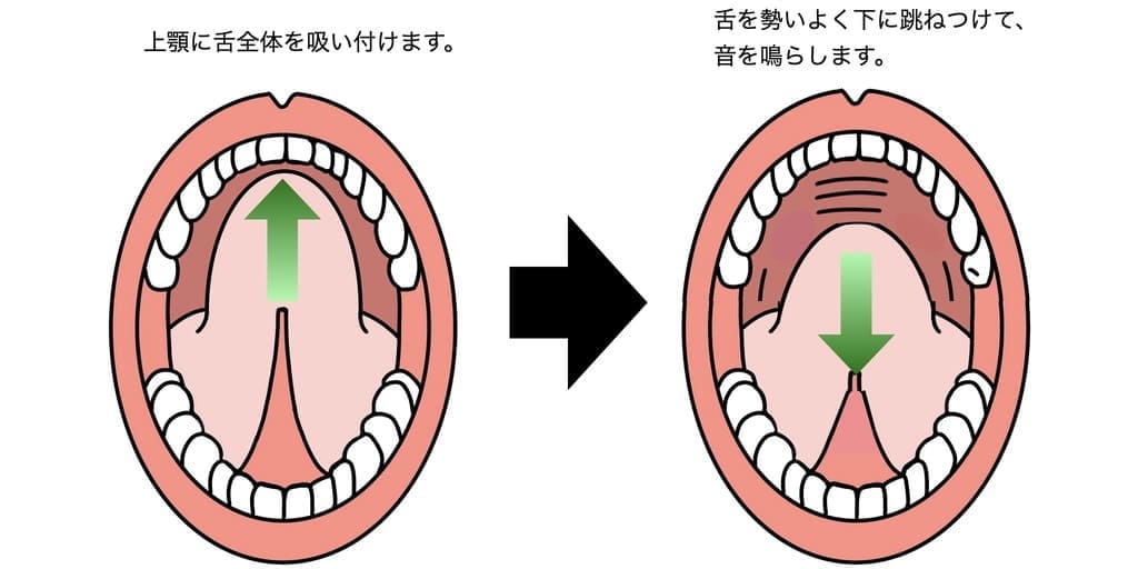 舌を上下させる運動療法の画像