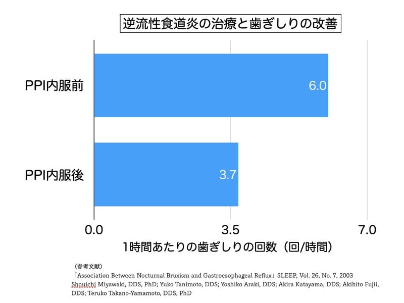 逆流性食道炎の治療による歯ぎしりの改善を示す画像