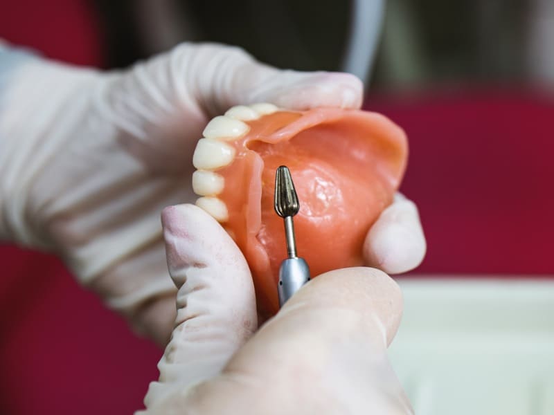 入れ歯の調整の画像