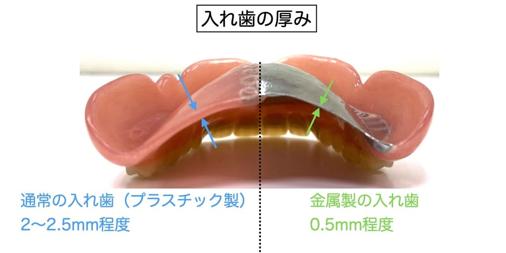 入れ歯の厚みの解説画像