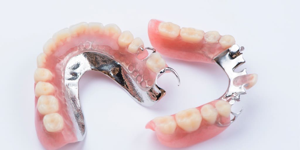 金属床義歯の画像