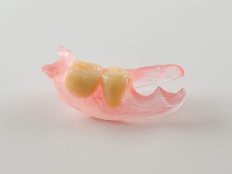 金属のバネ（金具）のない入れ歯の画像