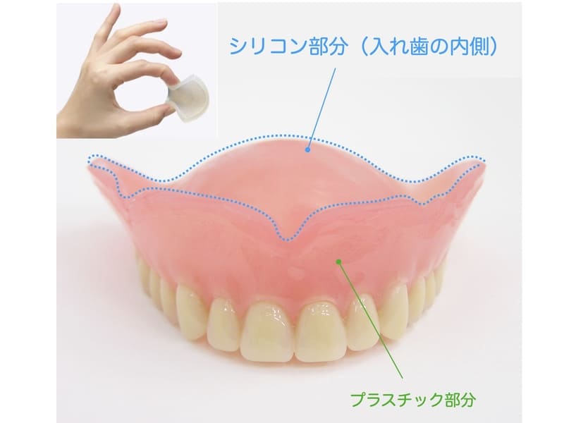 シリコン製入れ歯の画像