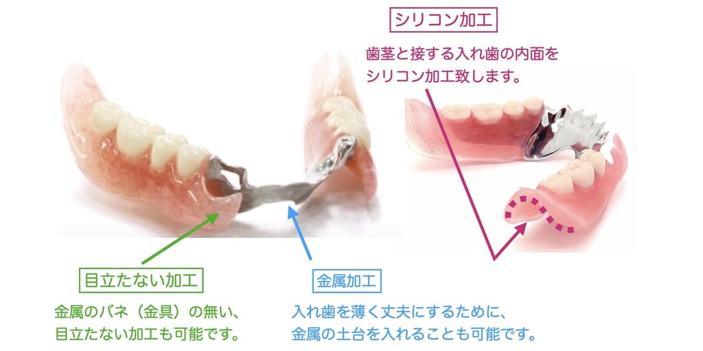 シリコン製入れ歯の解説画像