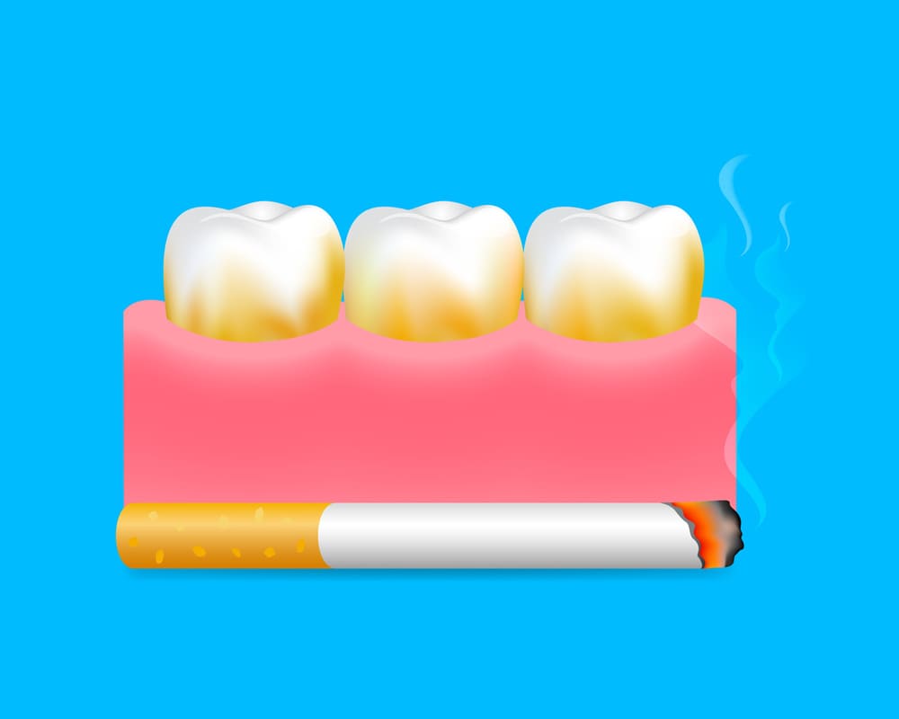 タバコと歯茎の画像