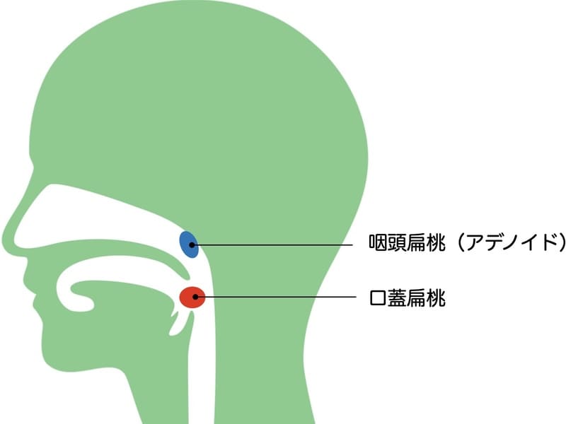 口蓋扁桃、アデノイドの画像