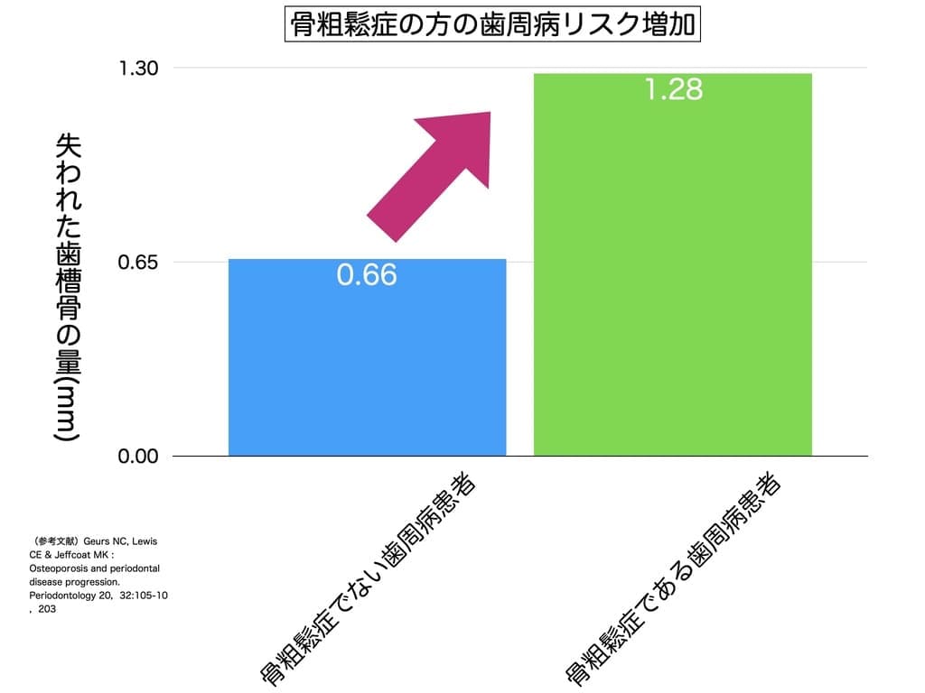 骨粗鬆症患者の歯周病リスク増加のグラフ画像