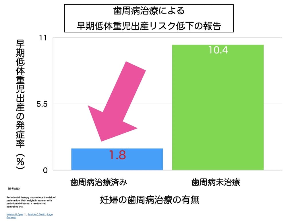 歯周病治療による早産・低体重児出産発症リスクの軽減を示すグラフ画像