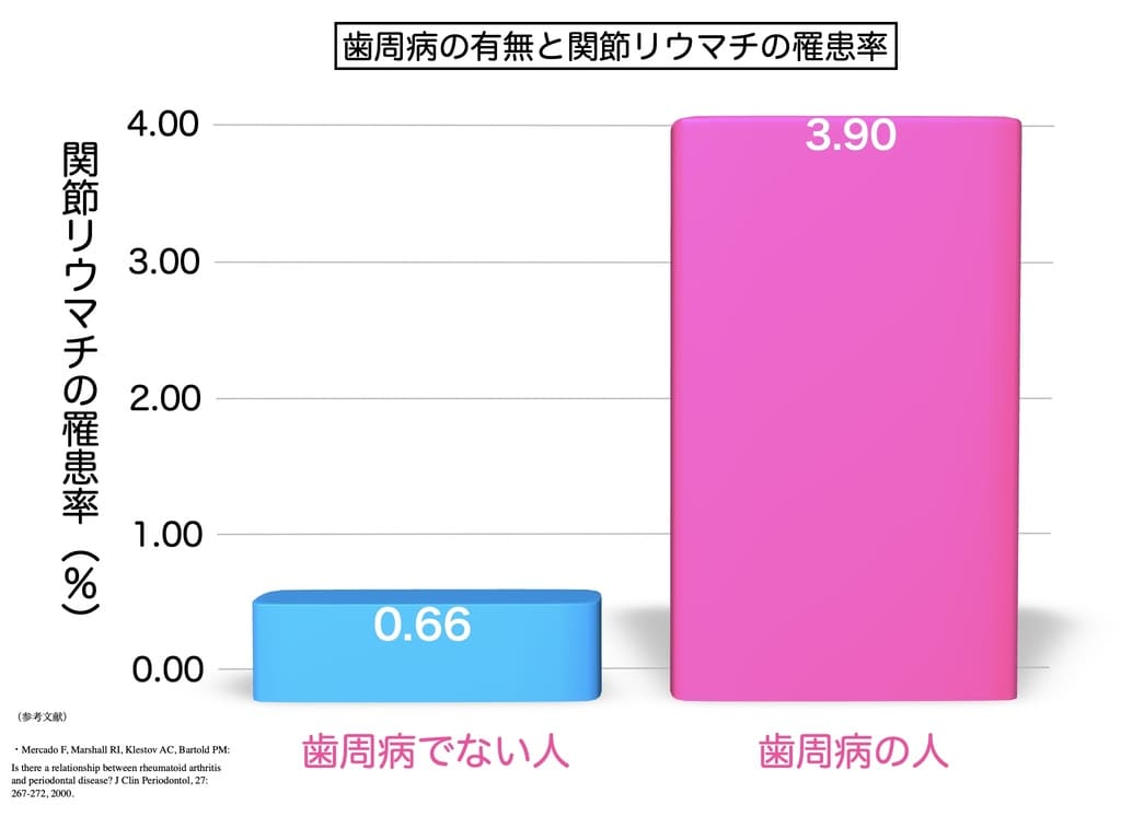 歯周病患者の関節リウマチ発症率の画像