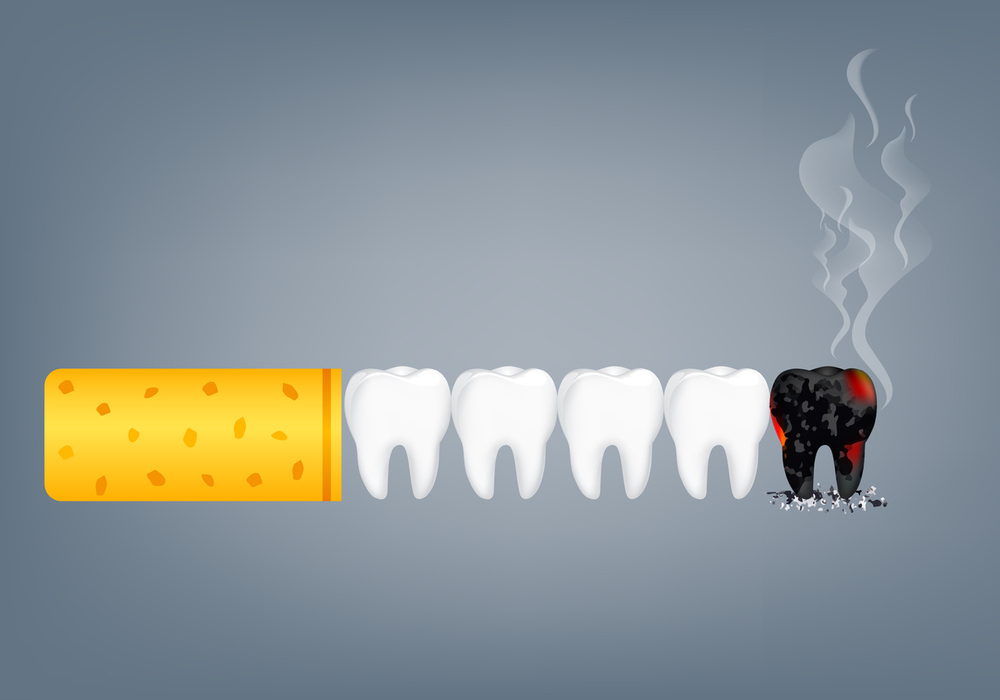 タバコが歯に与える影響を示すイラスト画像