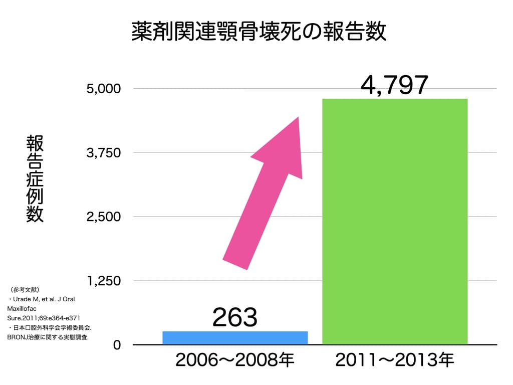 薬剤関連顎骨壊死の報告数の画像